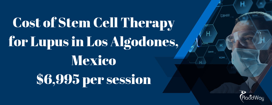 Cost of Stem Cell Therapy for Lupus in Los Algodones, Mexico